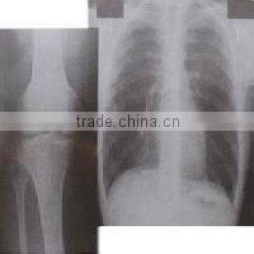 Konida Imagers x ra Blue Sensitive Films Medical Thermal Film China Film photo-3