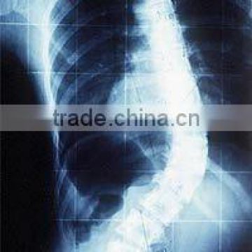 radiography film,CT/MRI/DR/CR/DSA film,thermal film,hologram thermal lamination film