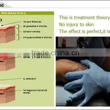 2016 CE Approved Tattoo Removal Laser 1500mj Machine China Laser Pigmented Lesions Treatment photo-4