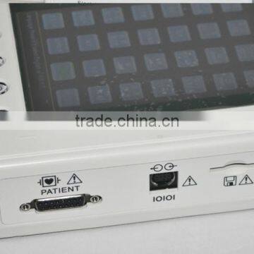 3-channel 12 Lead Color Screen EKG Electrocardiograph Portabel Ecg Machine photo-5