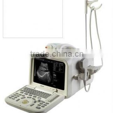 Full Digital Ultrasound Scanner with USB, Fast Start and Operation Speed