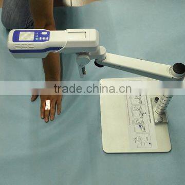 YSVV500 Good Selling Best Price Medical Portable Vein Finder for Sale photo-2
