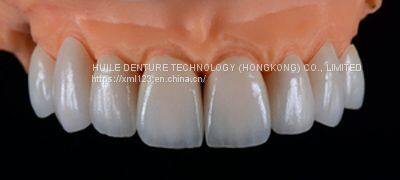 Metal-Free FDA All Zirconia Crown OEM Implant-Supported Dentures