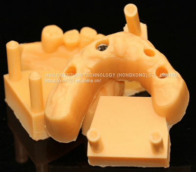 Digital-Crowns-Bridges Chinese Dental Lab Denture photo-2