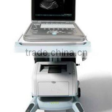 Sonostar Hospital Veterinary Equipment B Model Ultrasound Machine for Sale V9 photo-5