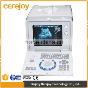 CE Approved full digital LCD display diagnostic laptop ultrasound scanner