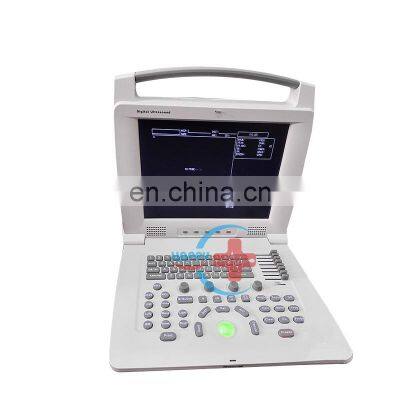 HC-A004 good quality mobile phone ultrasound scanner Digital portable ultrasound pregnancy scanner machine price