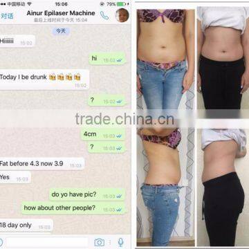 Hottest Criolipolisis Lipo Cryo Fat Freezing Machine 5 Handles Antifreeze Membrane for Cryolipolysis photo-4