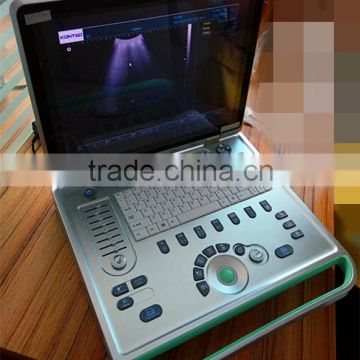 Full Digital Imaging Technology Portable Sheep Pregnancy Ultrasound Scanner