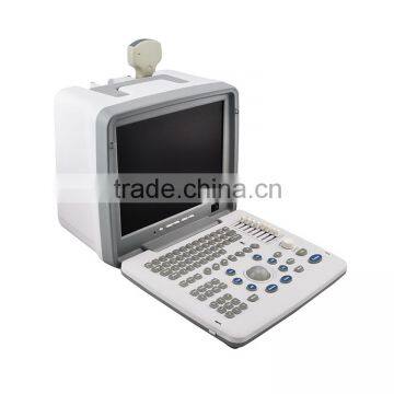 China Medical Ultrasonic Equipment pc Based Usb Ultrasound Scanner With Cheap Price photo-4
