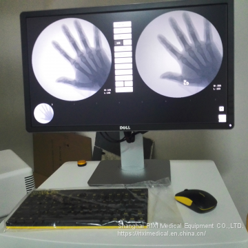 RX2310C High Frequency Mobile Digital C-arm System photo-3