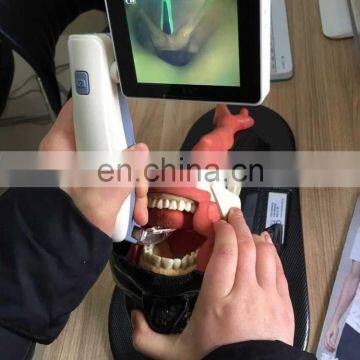 Hot Sale Video Laryngoscope Price Video Laryngoscope Portable Flexible Laryngoscope photo-3
