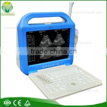 FM-3000B Best Selling Portable Full Digital Ultrasound