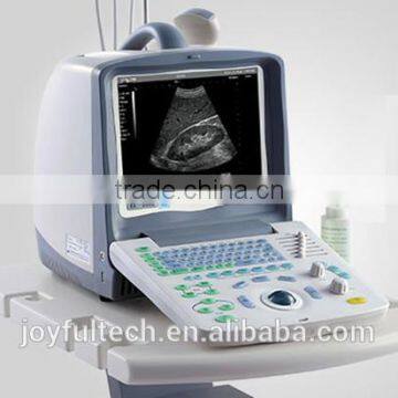 HOT!! Joyful laptop health and medical system best portable ultrasound machine price