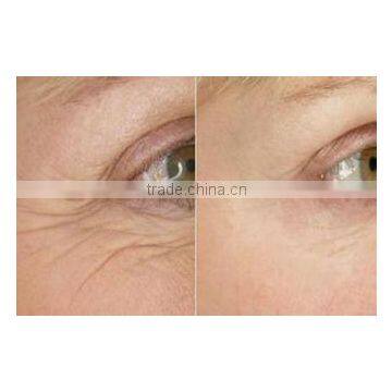 Portable Fractional rf Microneedle Wrinkle Removal Machine/skin Lifting Micro Needle rf Machine