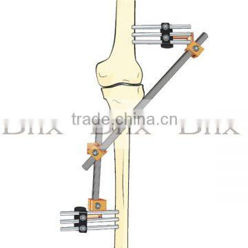 Circular External Fixator with multiple rings