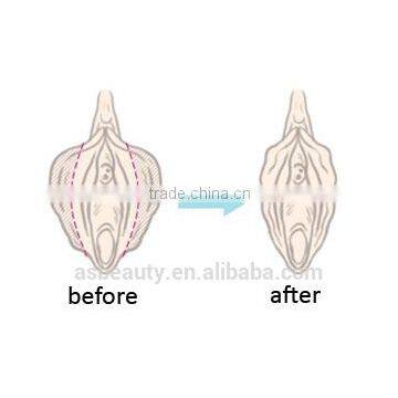 OEM Multifunction Clinical/medical/hospital Laser Vaginal Tightening Machine photo-6
