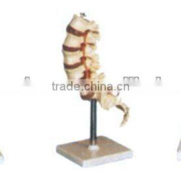 thoracic vertebra model / lumbar model / cervical vertebra model