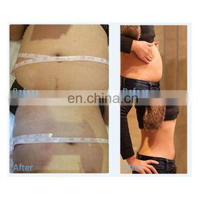 80K Cavitation Slimming Machine 80k Ultrasonic Cavitation Weight Loss Machine Vertical 80K Cavitation Ultrasonic Slimming photo-5