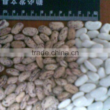 Kidney Beans ( White, Red and Black )