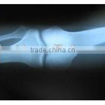 Manufacturer of medical x ray film,radiological dry film with CE,KND-A/F,fit for fuji and agfa printers