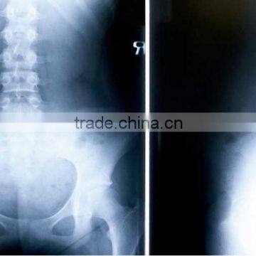 China KND-A/F CE medical dry film bulk medical supplies