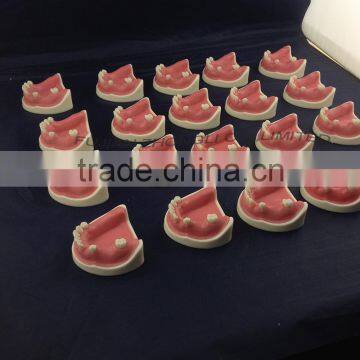 Medical Science Dental Implant Model With Soft Gingiva photo-2