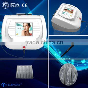 RBS Facial vascular treatment blood vessels removal laser machine