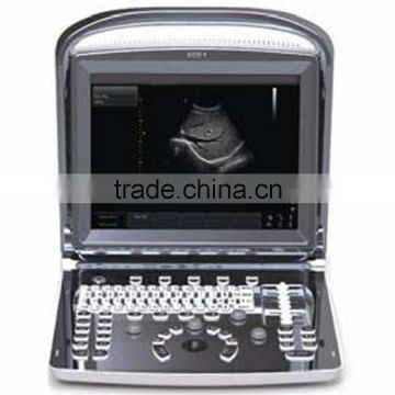 MCB-ECO1 CE FDA 12" LED Fully Digital Portable Ultrasound Machine