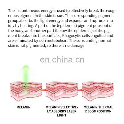 Portable Q-switch Laser Machine ND YAG Tattoo Removal Laser Machine Eyebrow Removal Pigmentation Carbon Peeling Machine photo-5