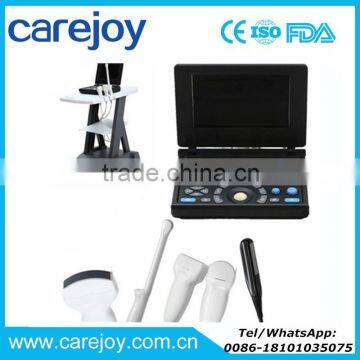 CE ISO certified Laptop Ultrasound Scanner with Multi-frequency probe Aluminum box