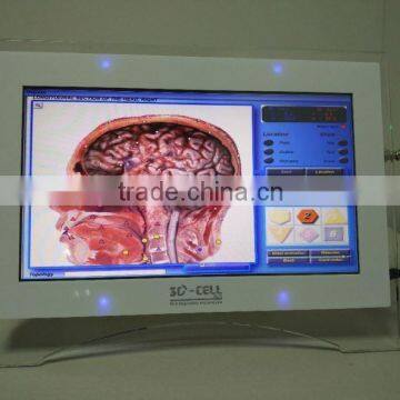 high quality 3D-NLS Health Analyzer cheap price