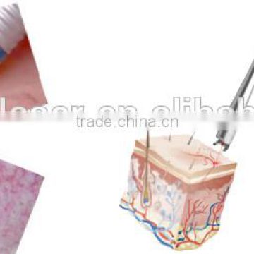 High quality cure the vascular, red face care 980nm diode laser