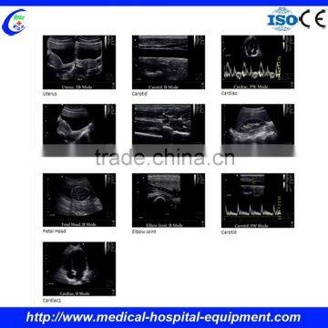 Ultrasound Linear Probe photo-2