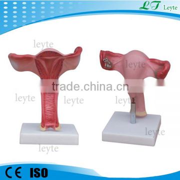 XC-436A medical PVC Uterus Model