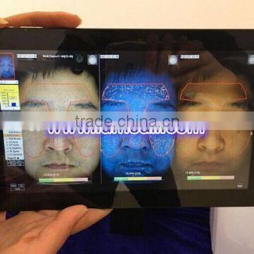 UV Light 3D Face Camera Magic Mirror Skin Analyzer for Face photo-5