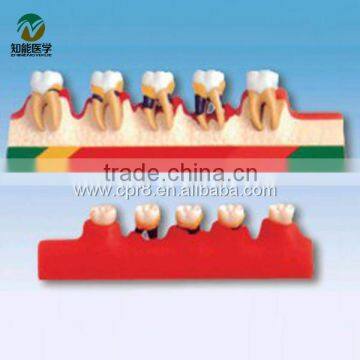 BIX-L1010 Periodontal Disease Model