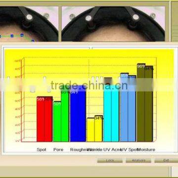 2016 High Quality 3d Magic Mirror Facial Visia Skin Analyzer Magnifier Machine photo-2
