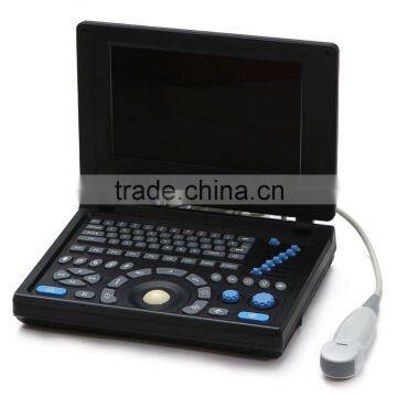 2016 CE&ISO Best Price of Portable/Notebook/Laptop Ultrasound Scanner/machine With Convex, Linear, Vaginal, Rectal Transducer photo-2