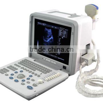 Portable LED Ultrasound Scanner with Convex probe RUS-9000B