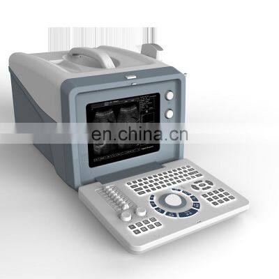 Medical 10inch Pregnancy LED Portable B&W Ultrasound Scanner Machine