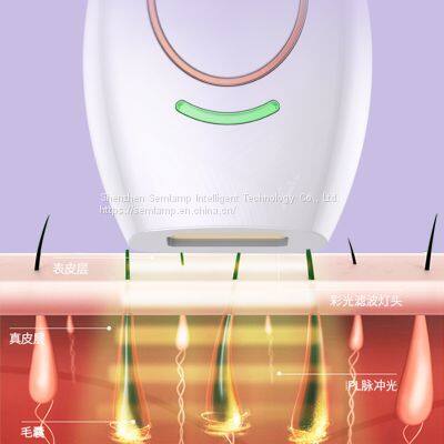 Semlamp Type-C IPL Hair Removal Machine At Home OEM/ODM photo-3