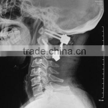 dt2b/diht/dvb medical x ray films agfa /fuji x-ray equipments prices high quality film x ray