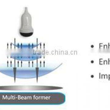 Mobile 4D Color Doppler Ultrasound Systme Chison Trolley Ultrasound photo-5