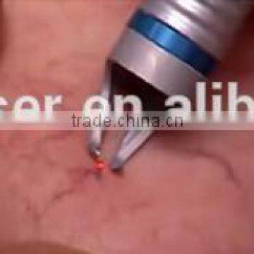 980nm Portable Diode Laser Spider Vein Removal Machine photo-6