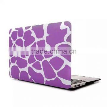 Plastic Crystal Hardshell Hard Case Cover For New Apple Mac Book photo-3