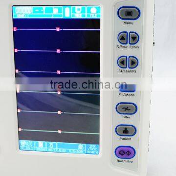 CE*ISO Certified Resting 12 Lead Signal 7 Inch 6 Channel Digital Electrocardiograph ECG Machine Monitor EKG 1206A photo-3