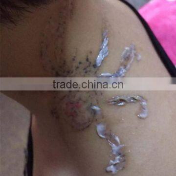 Naevus Of Ota Removal Q Switch Nd Yag Laser Mongolian Spots Removal Tattoo Removal Machine For Permanent Makeup 1 HZ