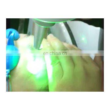 High quality yag laser q switched nd yag laser yag laser diode touch screen beauty equipment