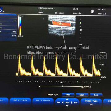 Популярный портативный цветной допплеровский ультразвуковой сканер медицинское оборудование для больниц photo-5